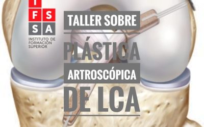 Taller de Traumatología Plástica Artroscópica de LCA.